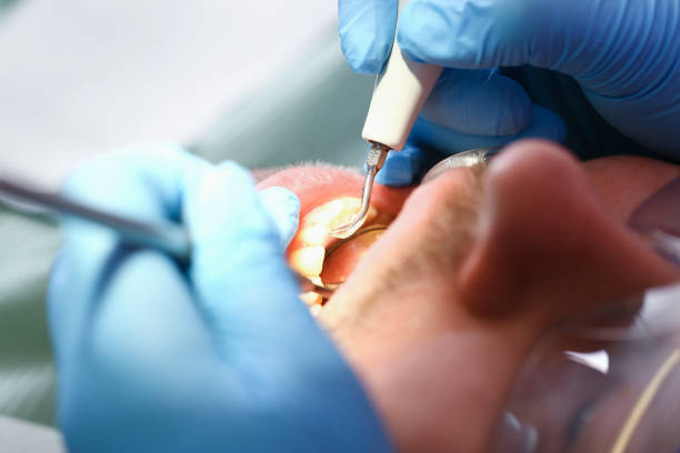 Best Emergency Tooth Extraction in Mount Airy, GA
