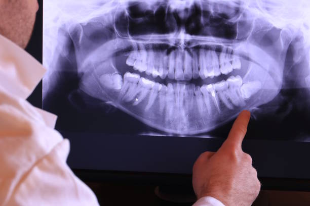 Best Emergency Denture Repair in Mount Airy, GA