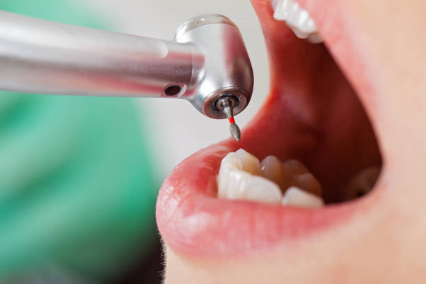Best After-Hours Dental Trauma Care in Mount Airy, GA